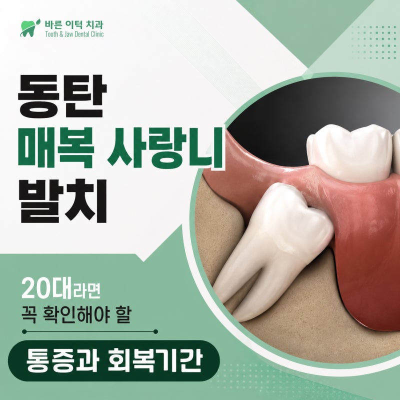 동탄 매복 사랑니 발치, 20대라면 꼭 확인해야 할 통증과 회복 기간
