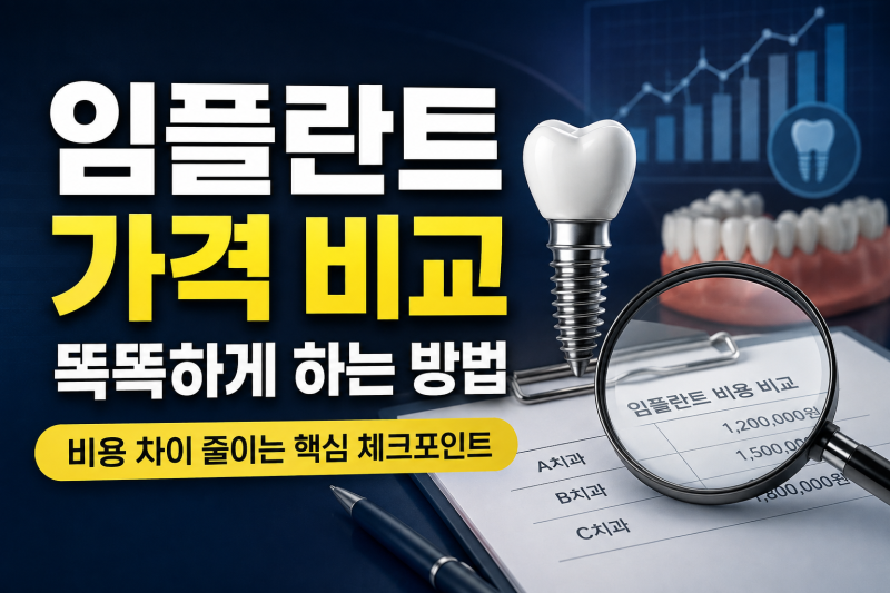 임플란트 가격 비교 사이트 어디서 볼까? 비용 확인할 때 체크할 기준