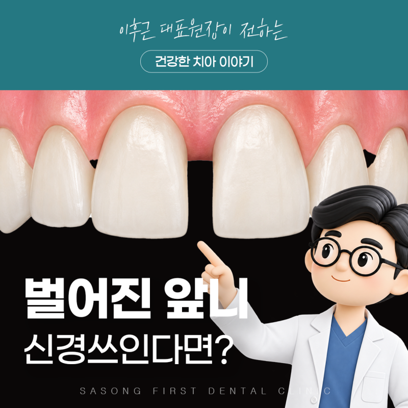 벌어진 앞니 사이, 레진으로 자연스럽게 메울 수 있을까요?