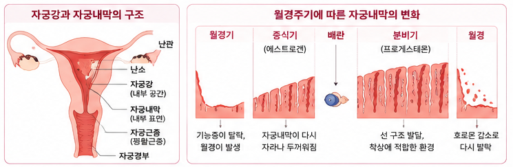 자궁강이란 무엇일까? 자궁내막 구조와 근종 용종으로 나타나는 증상