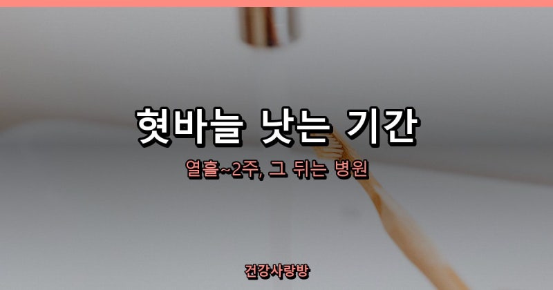 혓바늘 원인과 낫는 기간, 2주가 지나도 그대로면 병원입니다
