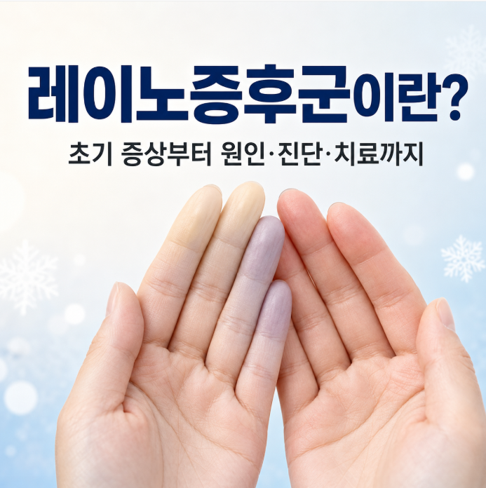 레이노증후군이란? 초기 증상부터 원인·진단·치료까지
