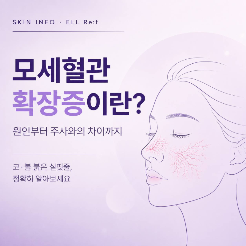모세혈관확장증이란? 원인과 증상, 주사와의 차이까지