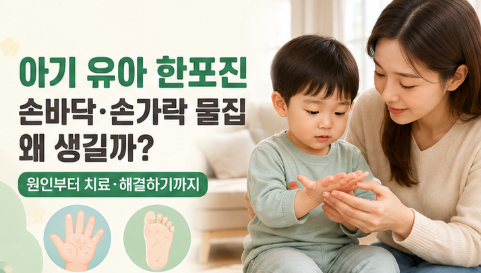 아기 유아 한포진 손바닥·손가락·발바닥 물집, 원인부터 증상 치료 해결하기