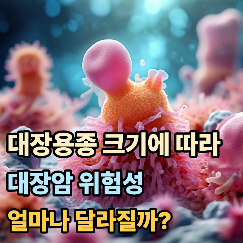 대장용종 5mm, 10mm, 20mm 크기에 따라 대장암 위험성이 어떻게 달라질까?