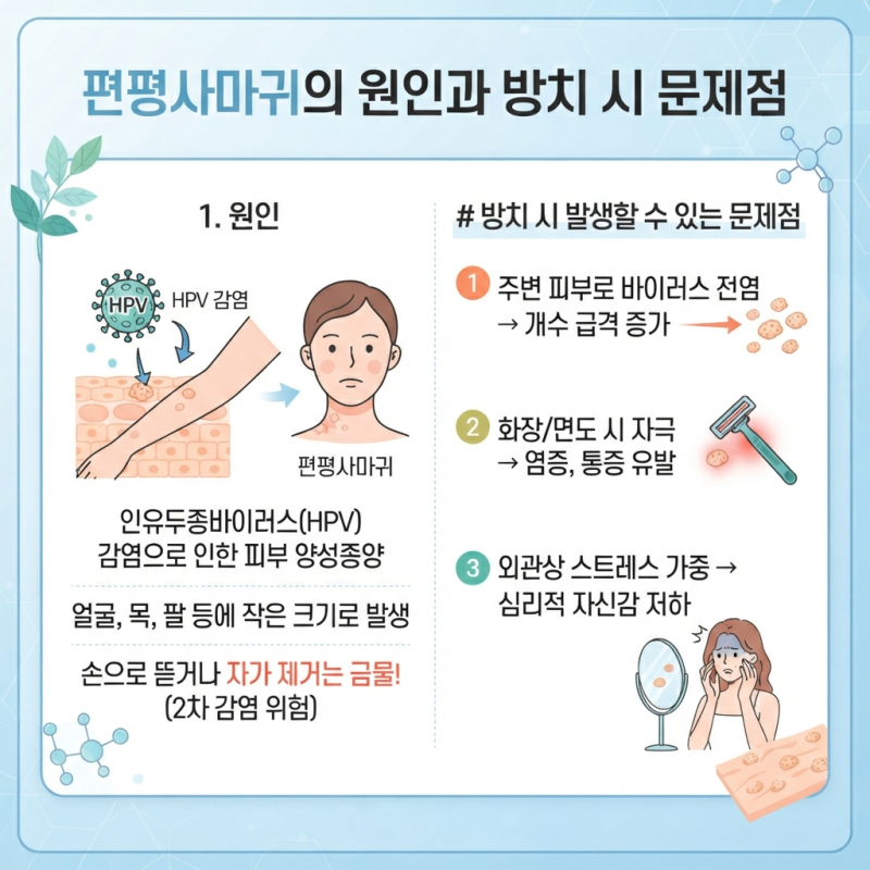 대구 편평사마귀 제거, 듀얼레이저와 맞춤 관리가 필수인 이유 [로담한의원 대구점]