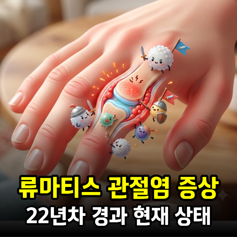 류마티스 관절염 22년차 경과 현재 상태, 증상과 혈액검사 정상 수치