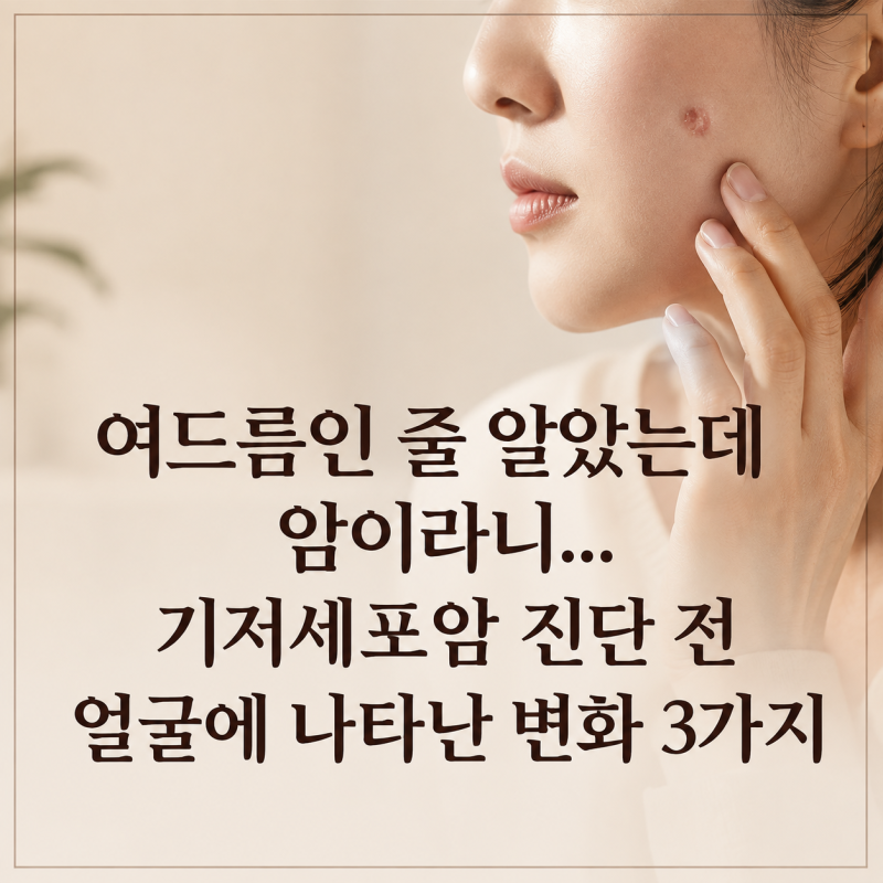 "여드름인 줄 알았는데 암이라니..." 기저세포암 진단 전 얼굴에 나타난 변화 3가지