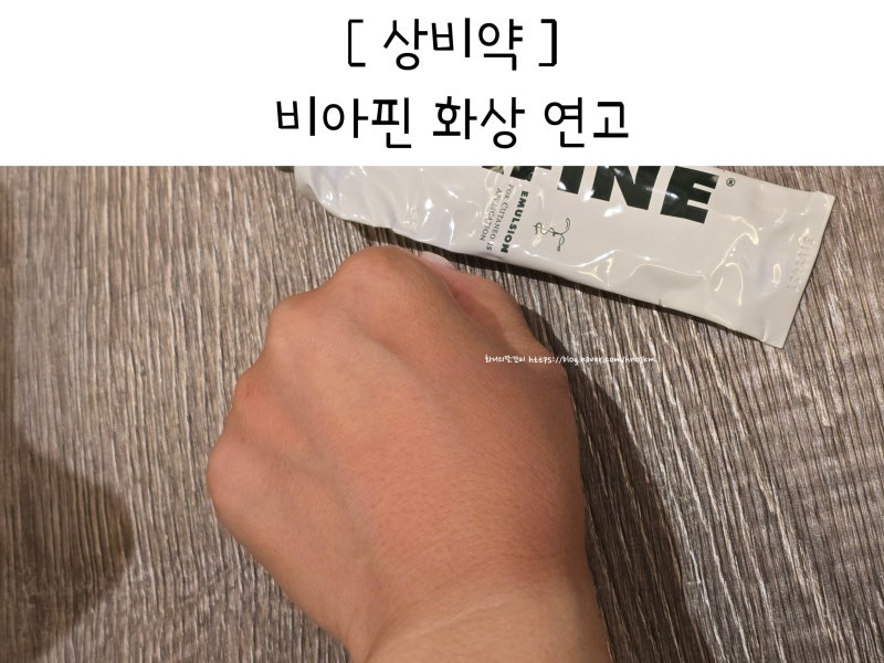 햇빛 화상 연고 비아핀 가정상비약 3년째 쓰는 추천 사용 후기