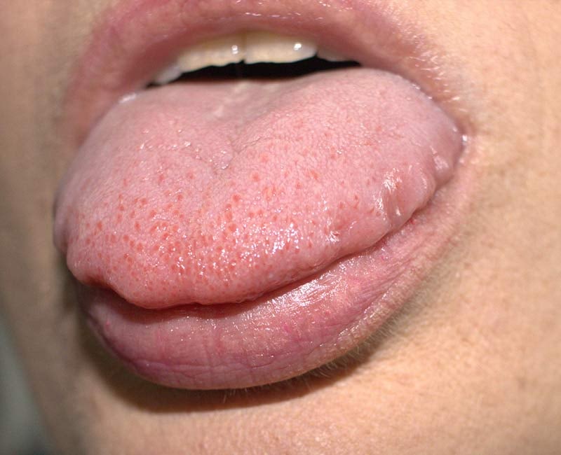 혀가 아픈데 왜 턱관절 검사를 하나요?혀 통증과 이악물기·턱관절 근육통의 관계