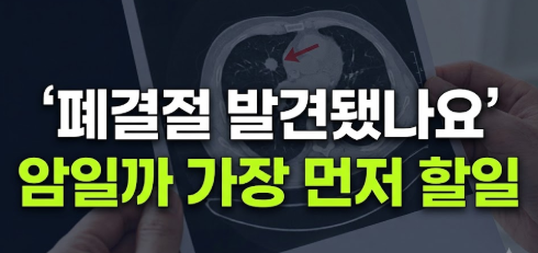 폐결절 원인 증상 발견 시 해야 할 일(+치료 방법)