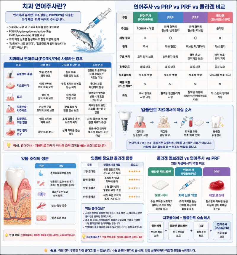 치과 연어주사란 뭘까?