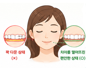 자면서 이를 갈아요!, 이갈이 어떻게 줄일 수 있을까요?