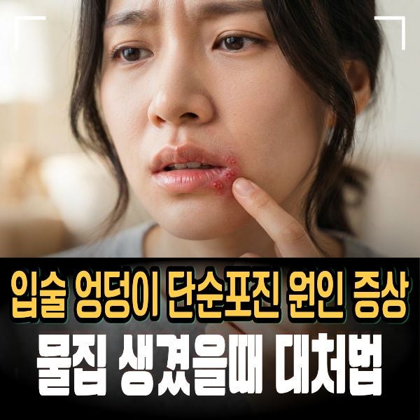 입술 엉덩이 단순포진 원인과 초기증상 5가지! 물집 생겼을때 대처법