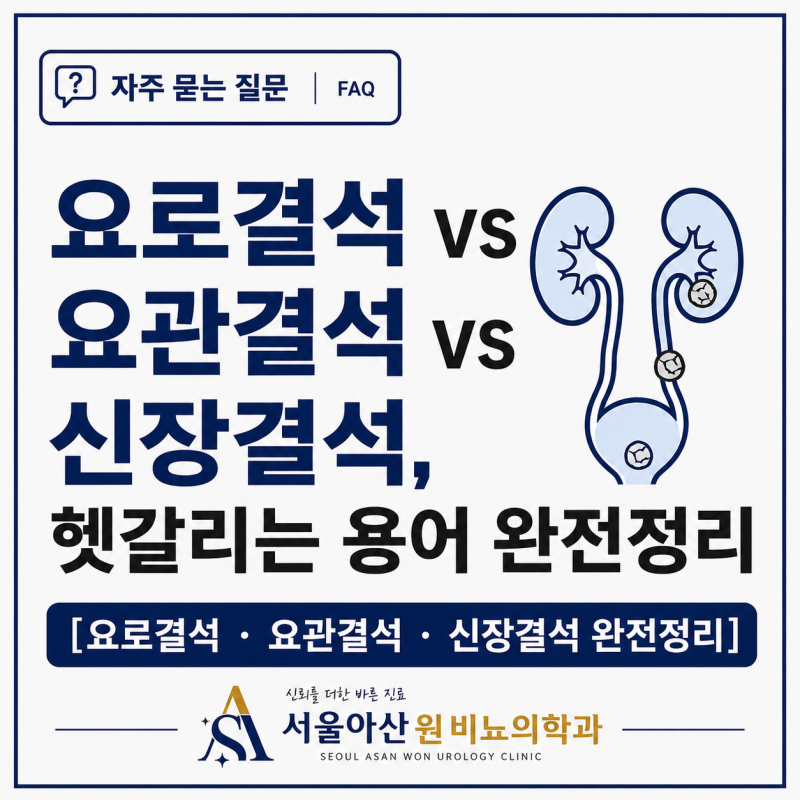요로결석 vs 요관결석 vs 신장결석, 헷갈리는 용어 완전정리