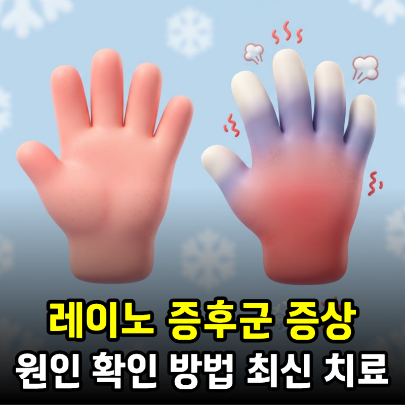 레이노증후군(레이노병) 증상, 피가 안 통해서 아프기까지한데 수족냉증일까?