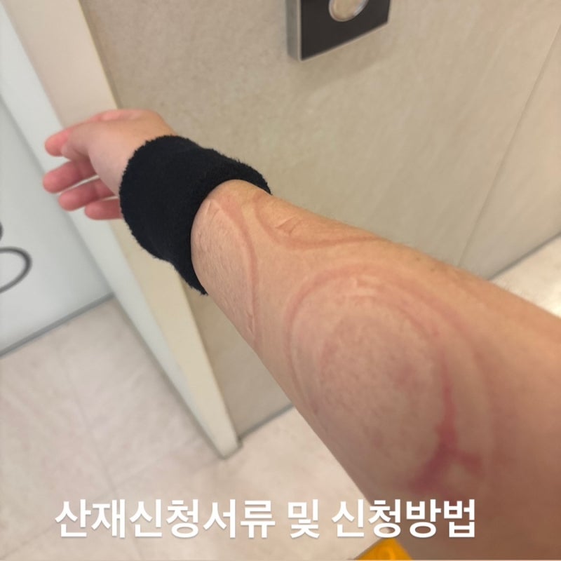 산재신청서류 작성 및 산재신청방법 후기 1탄, 회사에서 짐 나르다가 손목이 삐었을 때