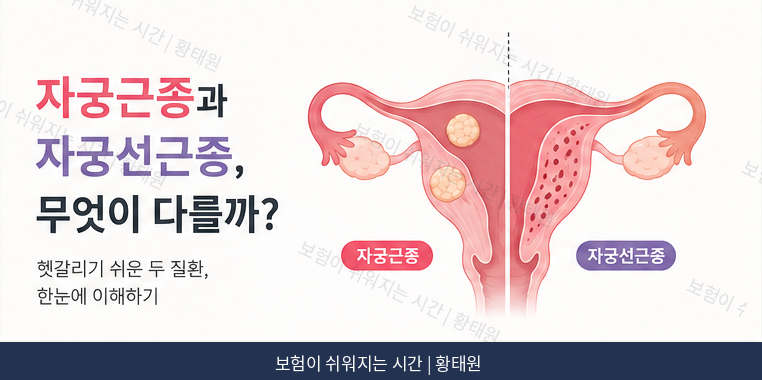 자궁근종과 자궁선근증, 뭐가 다른 걸까?