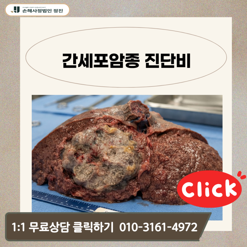 간세포암종 진단비, 조직검사 없는 C22 질병코드 거절 시 어떻게 해결할까?