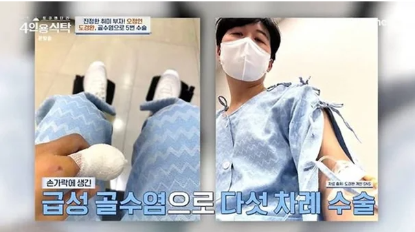 "이거 가짜 손톱이에요" 도경완이 검지 보여주며 꺼낸 고백