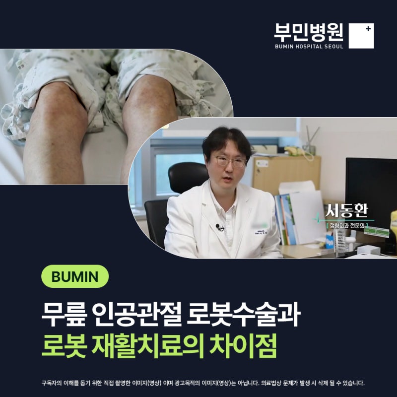 무릎 인공관절 로봇수술 & 로봇재활, 뭐가 진짜 다를까?(feat.서울부민병원 로봇인공관절센터 ....