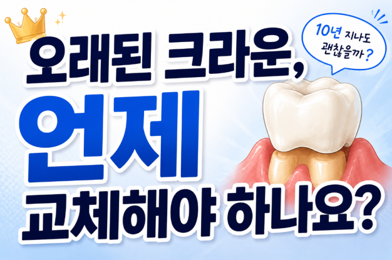 오래된 크라운 언제 교체해야 하나요?