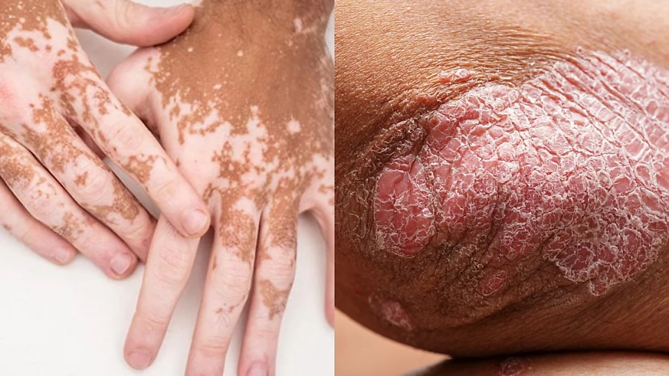 피부과(Dermatology)
