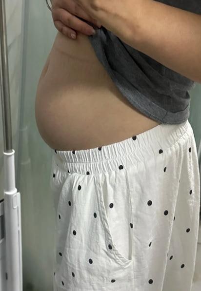 마운자로 효과와 용량별 가격, 부작용 대처법과 처방 기준까지