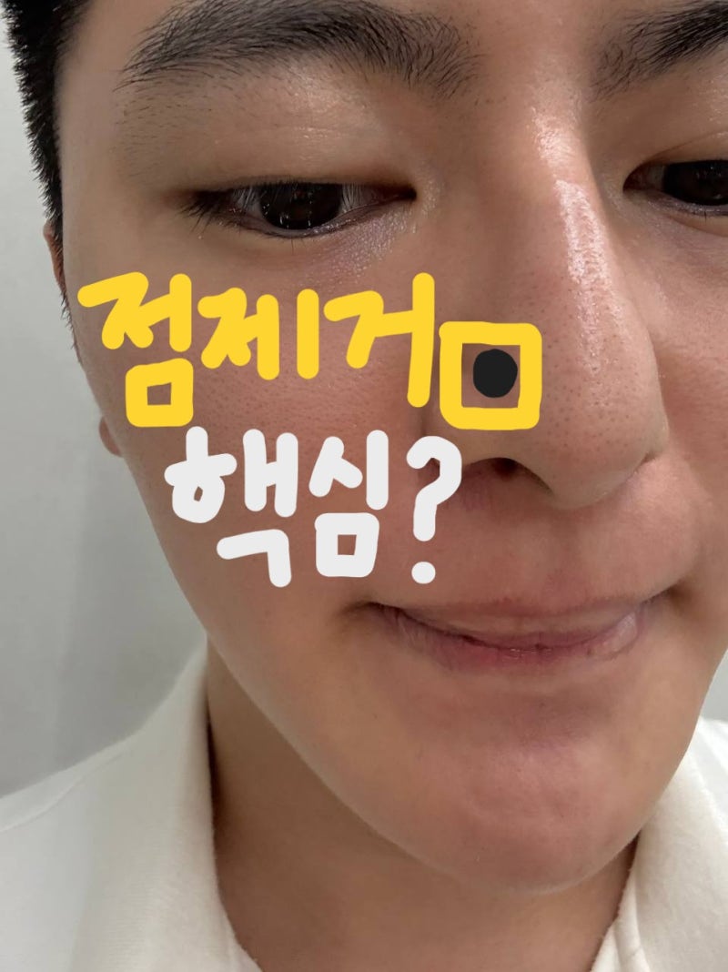 천안점빼기피부과, 점 빼기 전 체크해야 될 정보는?