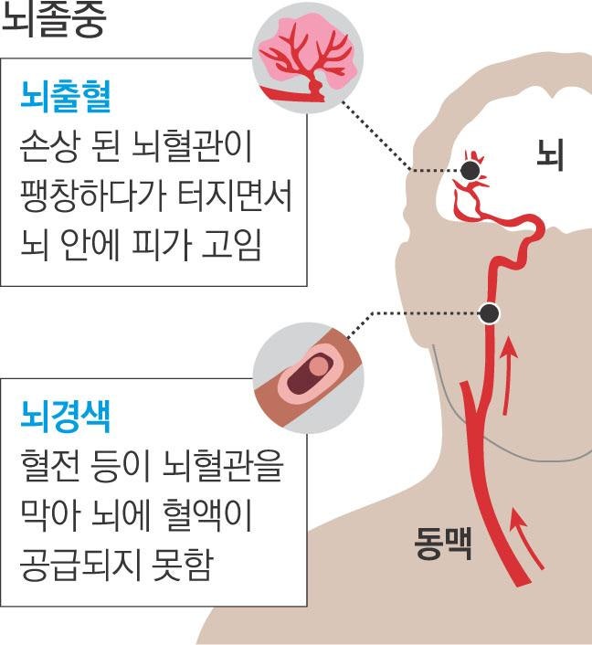 뇌경색과 뇌졸중의 차이부터 예방까지 총정리｜혈관 건강을 지키는 생활습관과 의료관리
