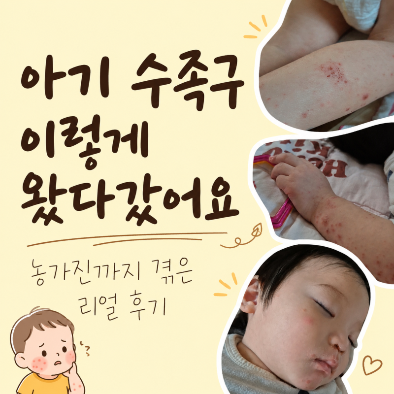 아기 수족구 증상, 콧물감기인 줄 알았는데 농가진까지 왔던 후기