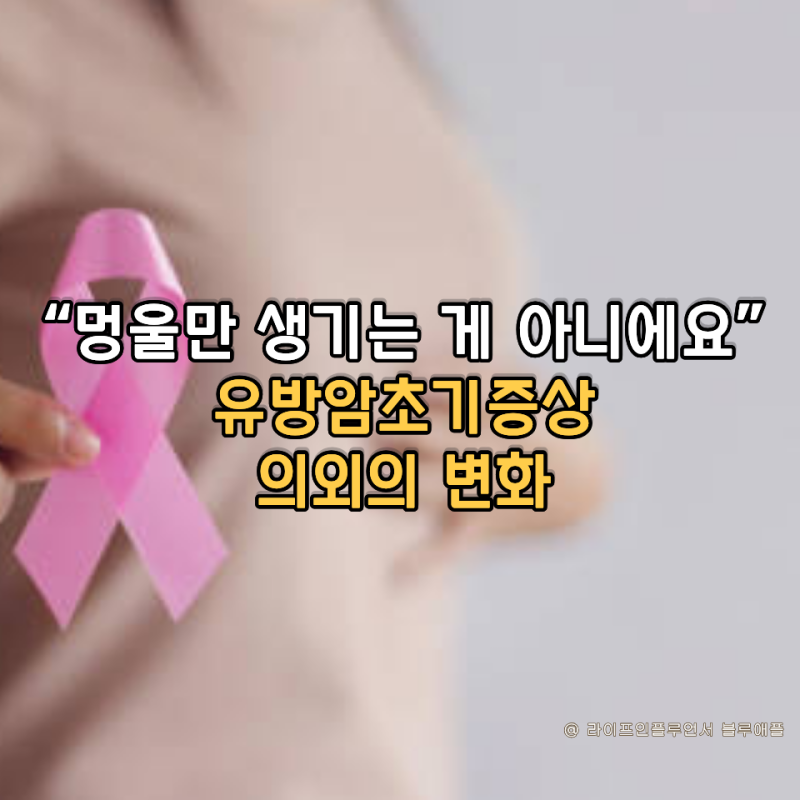 “멍울만 생기는 게 아니에요” 유방암초기증상 의외의 변화