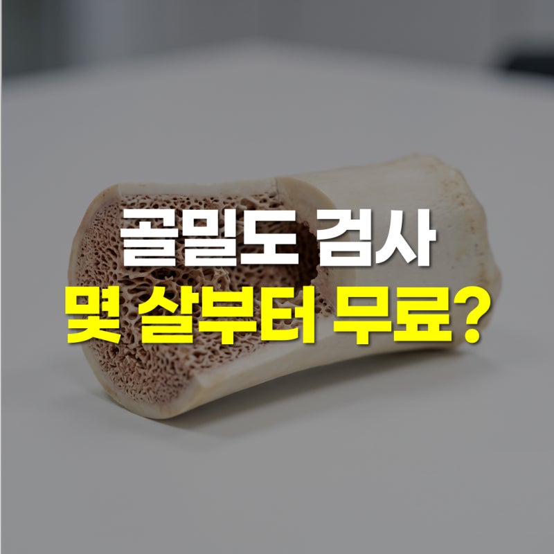 골밀도 검사 몇 살부터? 국가 무료 대상 나이와 조건