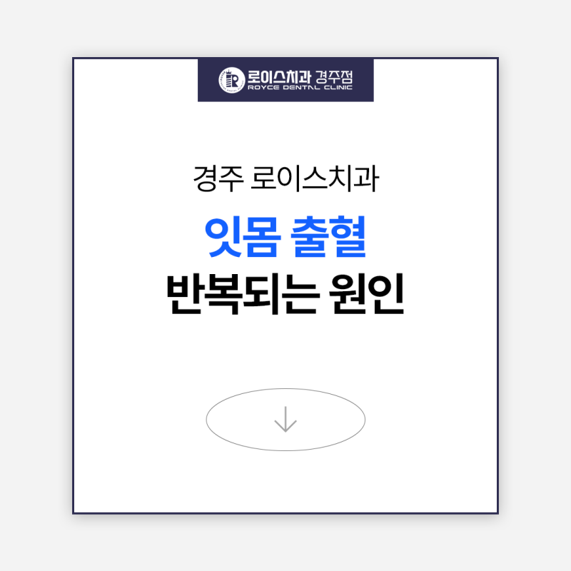 잇몸 피고임, 잇몸 출혈이 반복되는 원인 3가지