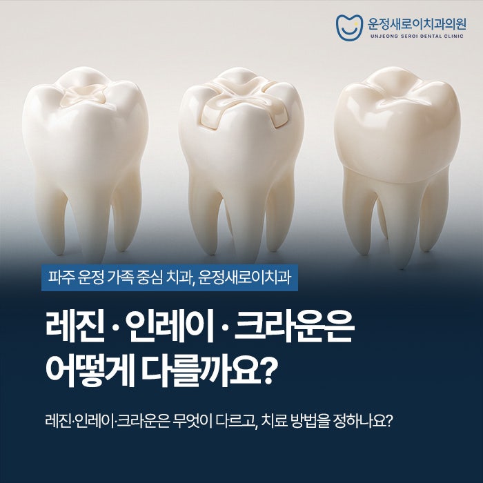 파주운정 충치치료 종류, 레진·인레이·크라운은 어떻게 다를까요?│동패동 운정새로이치과