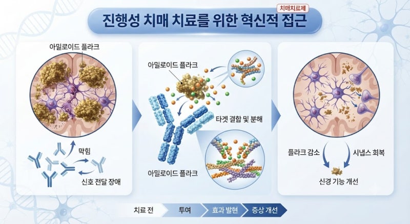레켐비 보험사별 정리(치매치료제보험)