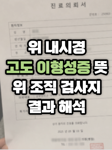 위 내시경 고도이형성증 진단 뜻, 위 조직검사 결과지 해석 대학병원 전원 후기
