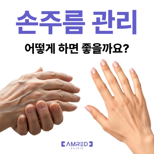 손주름 없애는 법, 내 손이 너무 나이 들어 보인다면