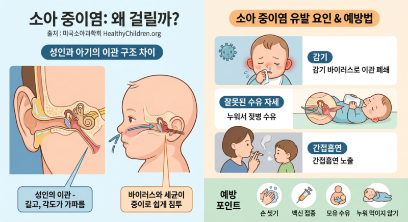 [미국소아과학회 AAP 출처] 아이들은 왜 중이염에 잘 걸릴까? 증상부터 치료·예방법까지 정리....