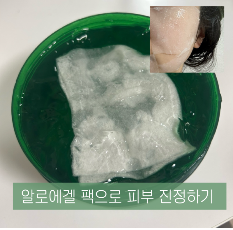 여름철 피부관리, 1일 1팩 수분 진정에 좋은 알로에겔 팩하기