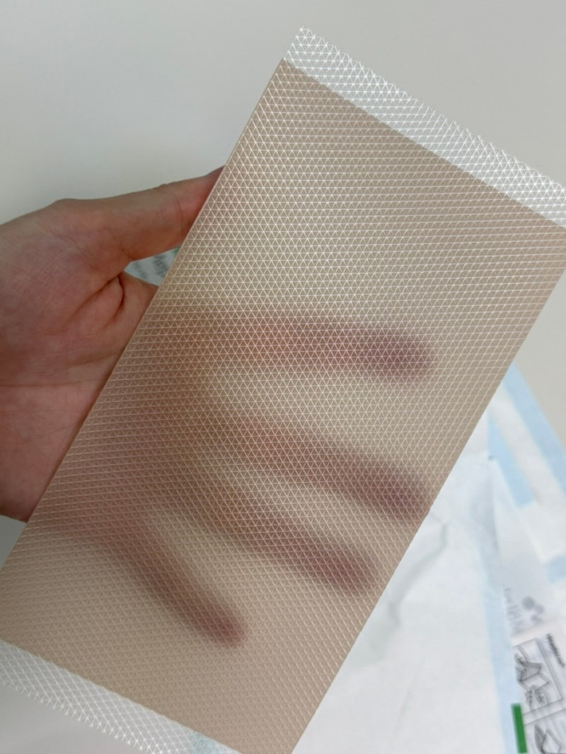 제왕절개 켈로이드 흉터관리, 시카케어 메피폼 아마존 직구부터 사용 후기까지