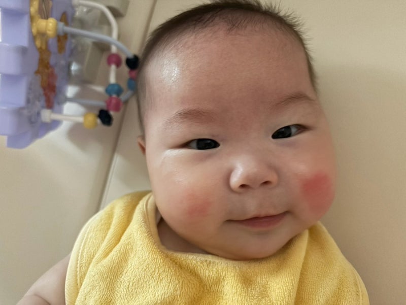 아기침독 볼빨개짐 비판텐 침독관리 후기