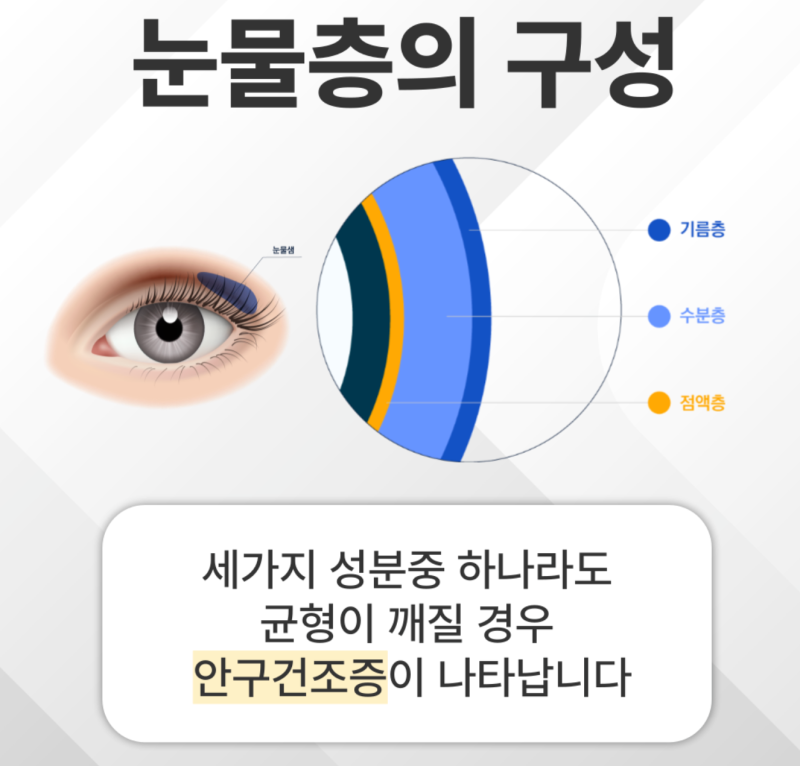 안구건조증 원인과 증상, 안구건조증에 좋은 영양제와 생활 습관