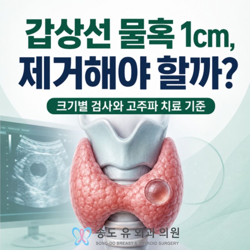 갑상선 물혹 1cm, 제거해야 할까? 크기별 검사와 고주파 치료 기준