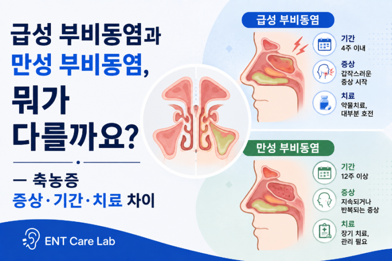 급성 부비동염과 만성 부비동염, 뭐가 다를까요? — 축농증 증상·기간·치료 차이
