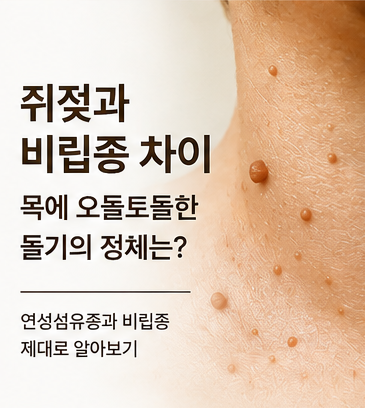 쥐젖과 비립종 차이, 목에 오돌토돌한 돌기의 정체는?ㅣ연성섬유종과 비립종 제대로 알아보....