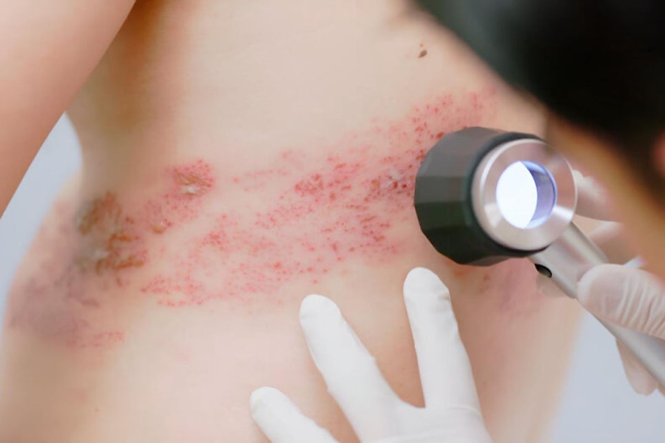 피부과(Dermatology)