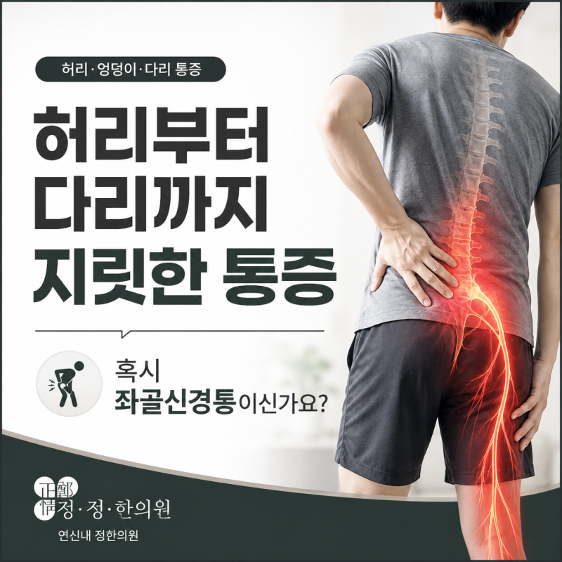 은평구 연신내, 좌골신경통! 단순 근육통으로 착각하면 안 되는 이유