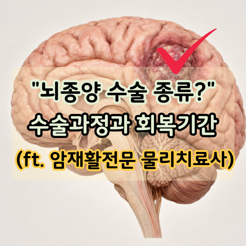 "뇌암 진단 후 뇌종양 수술?" 뇌종양 수술과정과 회복기간 (ft. 암재활전문 물리치료사)