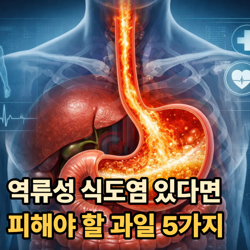 "이 과일들은 주의하세요"...역류성 식도염이 있다면 피해야 할 과일 5가지